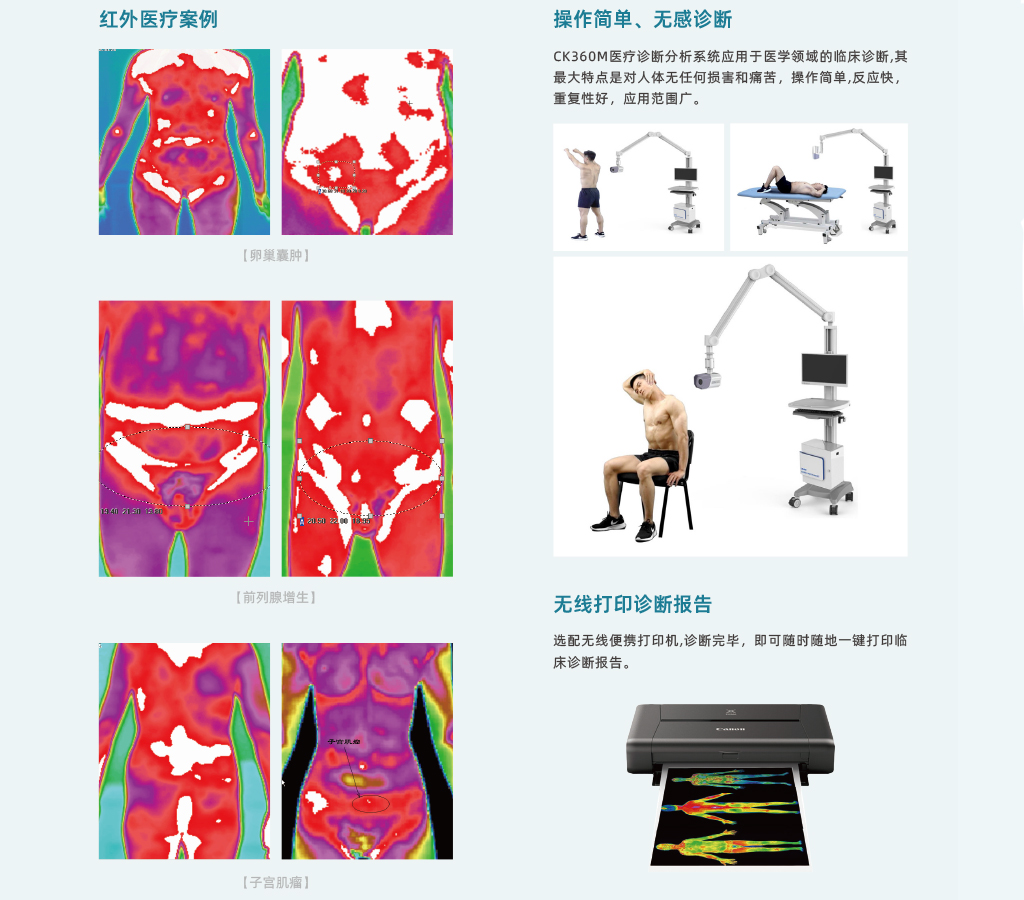 CK360-m医疗红外热像仪-飒特红外4.jpg CK360-m医疗红外热像仪-飒特红外4.jpg